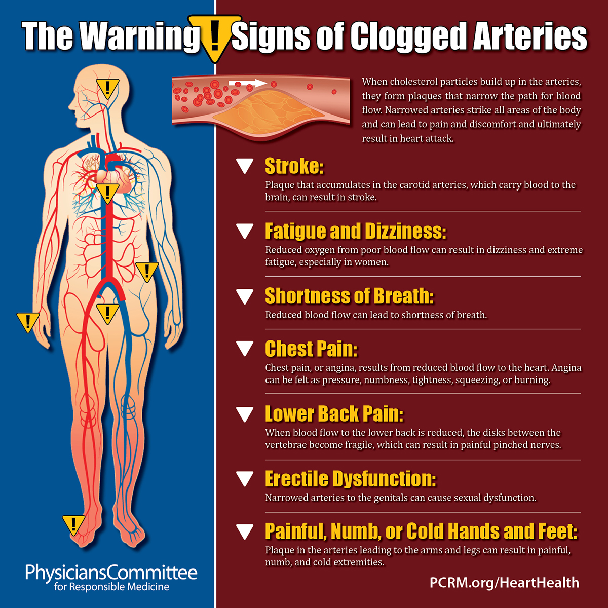 clogged-arteries-signs