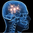 alzheimers