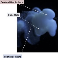 brain-cell-research