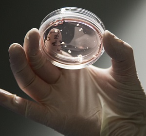 brain-organoids