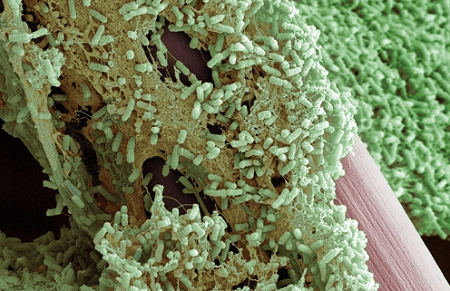 drug-resistant-bacteria
