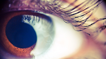 eye-disorders