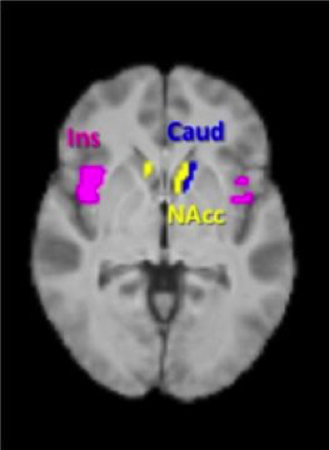 food-cravings-brain