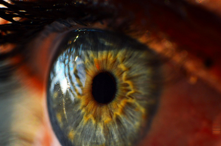 human-eye-alzheimers