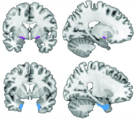 human-imaging-study
