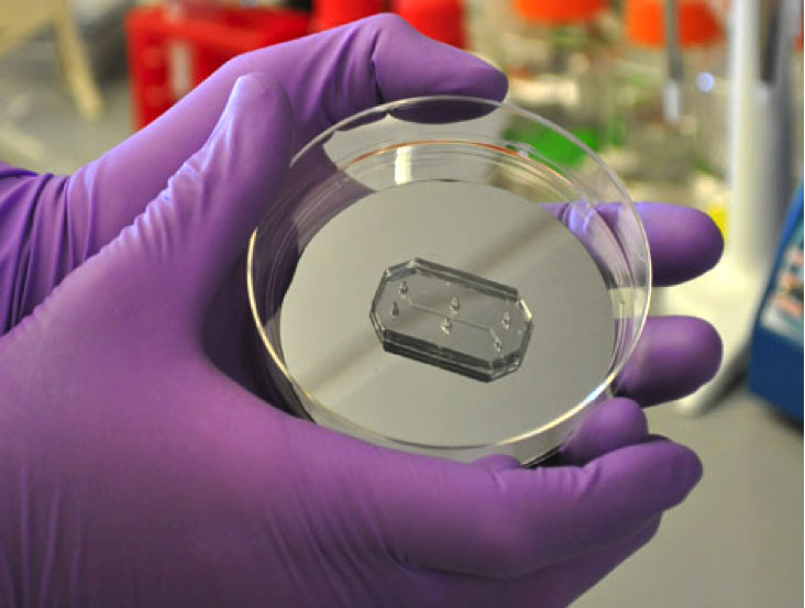 kidney-on-chip