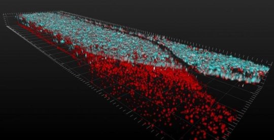 spinal-motor-neurons