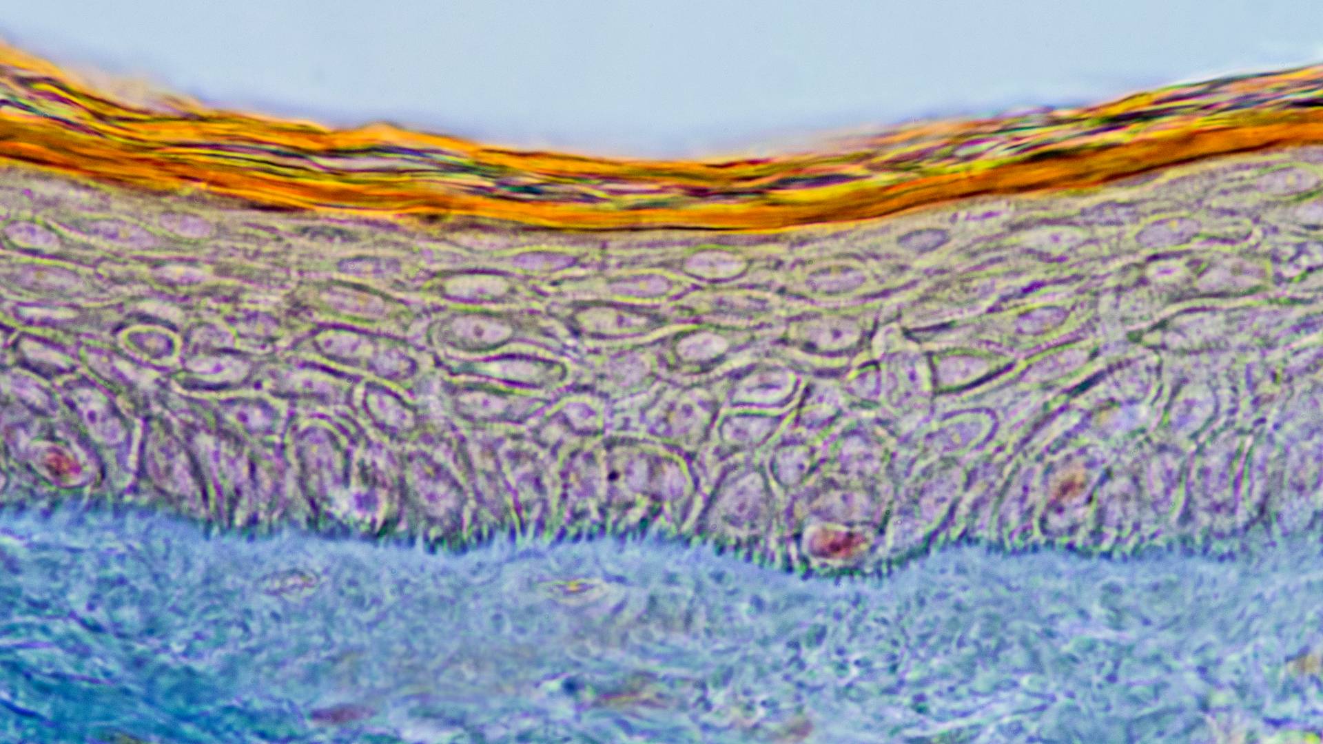 human scalp epidermis