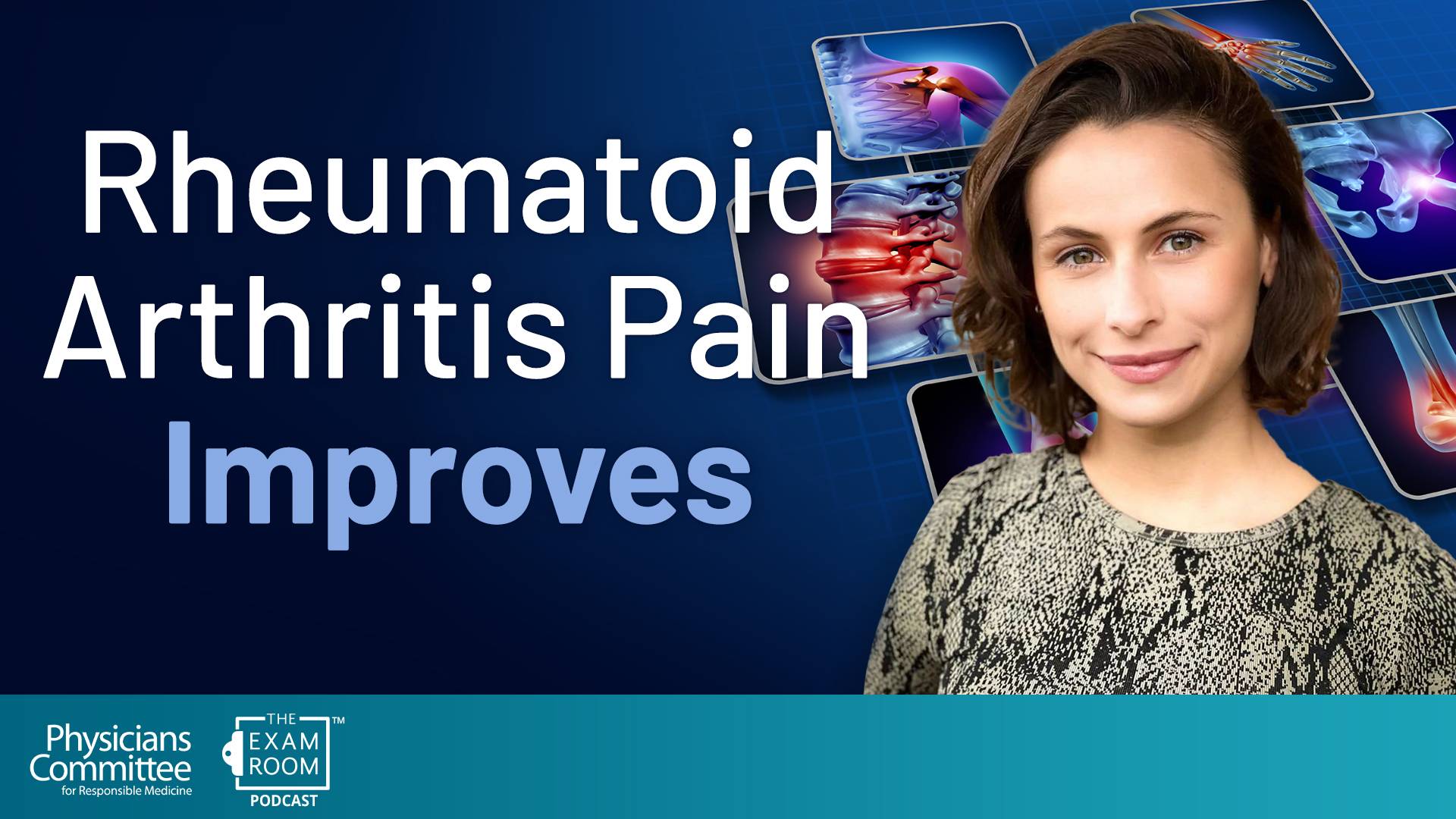 Vegan Diet Improved Crippling Rheumatoid Arthritis Pain