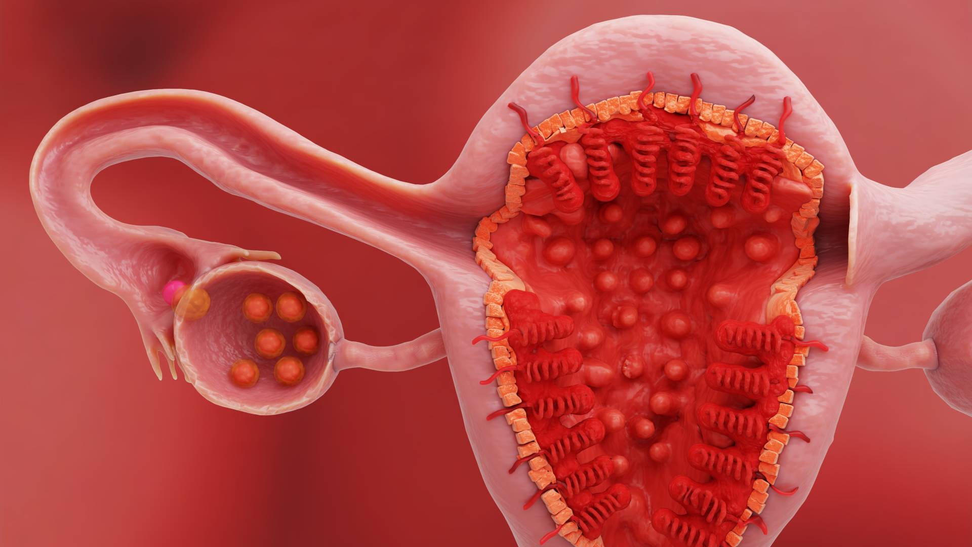 Uterus and ovary